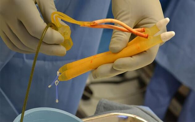 Penis implant